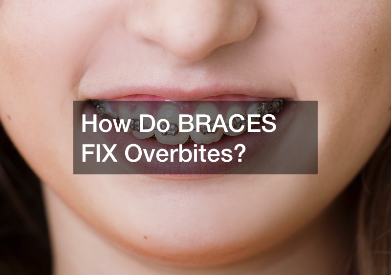 How Do BRACES FIX Overbites?