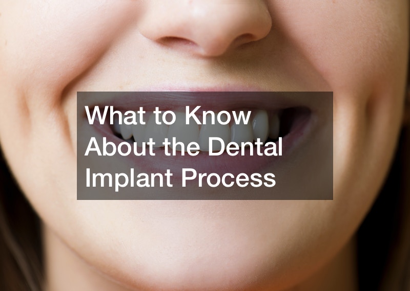 What to Know About the Dental Implant Process