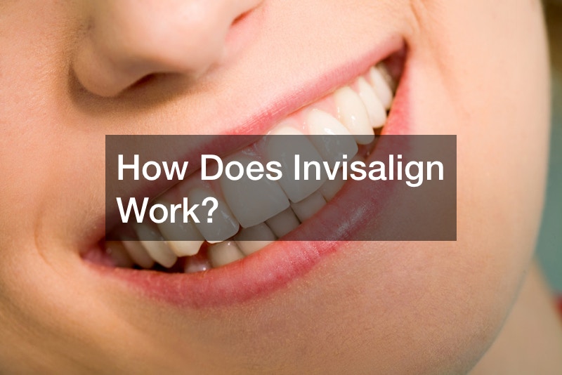 How Does Invisalign Work?